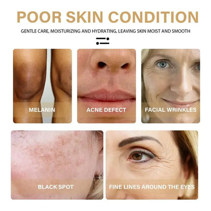 Dimollaure Whitening Face Cream Moisturizing Freckle Melasma Remove Brown Dark Spots Pigment Melanin Brighten Facial Skin Care